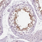 Immunohistochemical staining of human testis shows moderate cytoplasmic positivity in cells in seminiferous ducts.