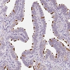 Immunohistochemical staining of human Fallopian tube shows strong positivity in cilia in glandular cells.