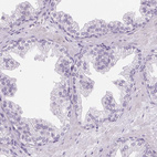 Immunohistochemical staining of human prostate shows no positivity in glandular cells as expected.