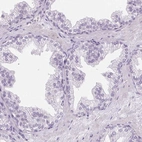 Immunohistochemical staining of human prostate shows no positivity in glandular cells as expected.