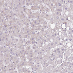 Immunohistochemical staining of human liver shows no positivity in hepatocytes as expected.