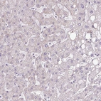 Immunohistochemical staining of human liver shows no positivity in hepatocytes as expected.