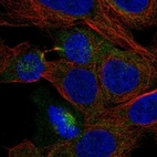 Anti-PHLPP2 Antibody