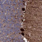 Anti-EXOSC9 Antibody