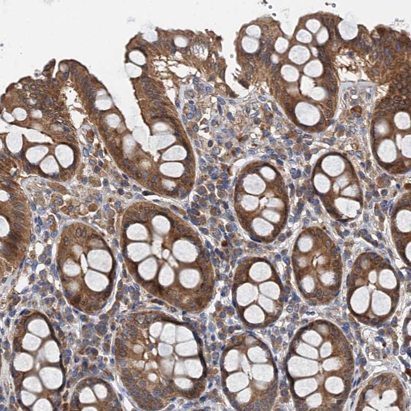 Anti-PPP1R14D Antibody