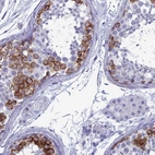 Anti-MAGEB6 Antibody