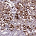 Anti-C19orf47 Antibody