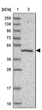 Lane 1: Marker [kDa] 250, 130, 95, 72, 55, 36, 28, 17, 10_br/_Lane 2: Human cell line RT-4