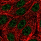 Immunofluorescent staining of human cell line MCF7 shows localization to nucleoplasm.