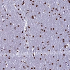 Anti-TIMM29 Antibody