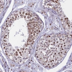 Immunohistochemical staining of human testis shows moderate to strong nuclear positivity in cells in seminiferous ducts.