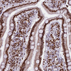 Immunohistochemical staining of human duodenum shows strong nuclear positivity in glandular cells.