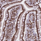 Immunohistochemical staining of human duodenum shows strong nuclear positivity in glandular cells.