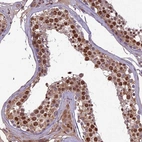 Anti-C3orf70 Antibody