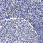 Immunohistochemical staining of human tonsil shows negative cytoplasmic positivity in non-germinal center cells and germinal center cells as expected.