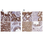 Immunohistochemical staining of human colon, kidney, liver and testis using Anti-UQCRFS1 antibody HPA041863 (A) shows similar protein distribution across tissues to independent antibody HPA050339 (B).