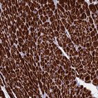 Immunohistochemical staining of human heart muscle shows moderate to strong cytoplasmic positivity in myocytes.