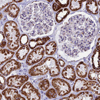Immunohistochemical staining of human kidney shows moderate to strong cytoplasmic positivity in cells in tubules.