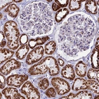 Immunohistochemical staining of human kidney shows moderate to strong cytoplasmic positivity in cells in tubules.