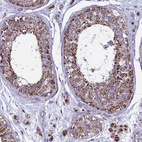 Immunohistochemical staining of human testis shows moderate to strong cytoplasmic positivity in cells in seminiferous ducts and in Leydig cells.