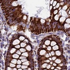 Immunohistochemical staining of human colon using Anti-UQCRFS1 antibody HPA041863.
