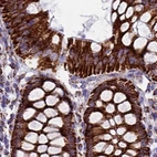 Immunohistochemical staining of human colon using Anti-UQCRFS1 antibody HPA041863.