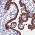 Anti-TMEM208 Antibody