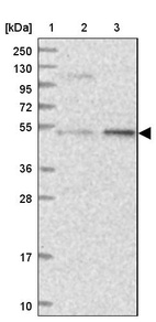 Lane 1: Marker [kDa] 250, 130, 95, 72, 55, 36, 28, 17, 10_br/_Lane 2: Human cell line RT-4_br/_Lane 3: Human cell line U-251MG sp