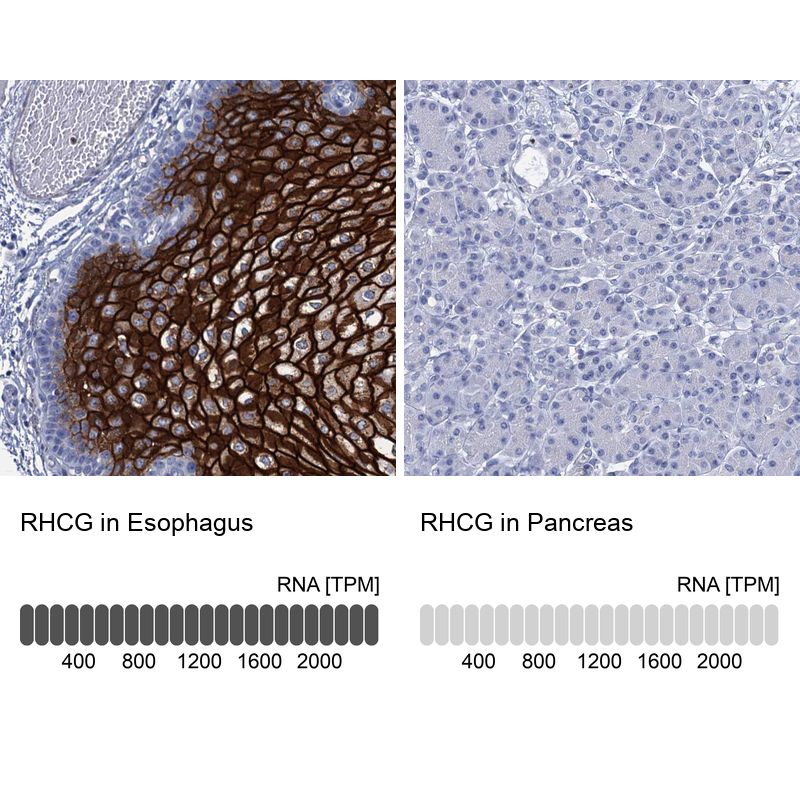 Anti-RHCG Antibody