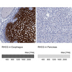 Anti-RHCG Antibody