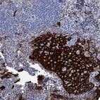 Immunohistochemical staining of human Tonsil shows strong membranous positivity in squamous epithelial cells.