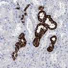 Immunohistochemical staining of human kidney shows strong membranous positivity in cells in distal tubules.