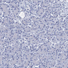 Immunohistochemical staining of human Pancreas shows no membranous positivity in exocrine glandular cells as expected.