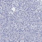 Immunohistochemical staining of human Pancreas shows no membranous positivity in exocrine glandular cells as expected.