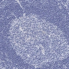 Immunohistochemical staining of human Lymph node shows no membranous positivity in non-germinal center cells as expected.