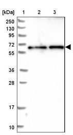 Lane 1: Marker [kDa] 250, 130, 95, 72, 55, 36, 28, 17, 10_br/_Lane 2: Human cell line RT-4_br/_Lane 3: Human cell line U-251MG sp