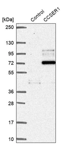 Western blot analysis in control (vector only transfected HEK293T lysate) and CCSER1 over-expression lysate (Co-expressed with a C-terminal myc-DDK tag (~3.1 kDa) in mammalian HEK293T cells, LY404048).