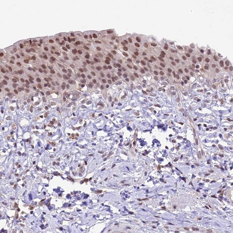 Anti-SHKBP1 Antibody