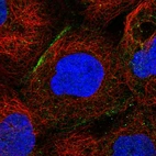 Immunofluorescent staining of human cell line A-431 shows localization to cell junctions.