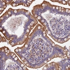 Immunohistochemical staining of human Small intestine shows strong membranous and cytoplasmic positivity in glandular cells.