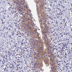 Immunohistochemical staining of human Urinary bladder shows moderate cytoplasmic positivity in urothelial cells.