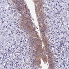 Immunohistochemical staining of human Urinary bladder shows moderate cytoplasmic positivity in urothelial cells.