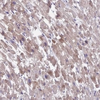 Immunohistochemical staining of human Heart muscle shows moderate cytoplasmic positivity in cardiomyocytes.