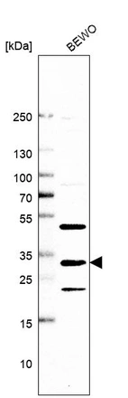 Western blot analysis in human cell line BEWO.