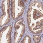 Anti-HN1L Antibody