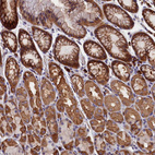 Immunohistochemical staining of human stomach shows moderate cytoplasmic positivity in glandular cells.