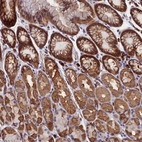 Immunohistochemical staining of human stomach shows moderate cytoplasmic positivity in glandular cells.