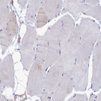 Immunohistochemical staining of human skeletal muscle shows very weak cytoplasmic positivity in myocytes.