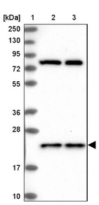 Lane 1: Marker [kDa] 250, 130, 95, 72, 55, 36, 28, 17, 10_br/_Lane 2: Human cell line RT-4_br/_Lane 3: Human cell line U-251MG sp
