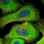 Immunofluorescent staining of human cell line U-2 OS shows localization to plasma membrane & cytosol.